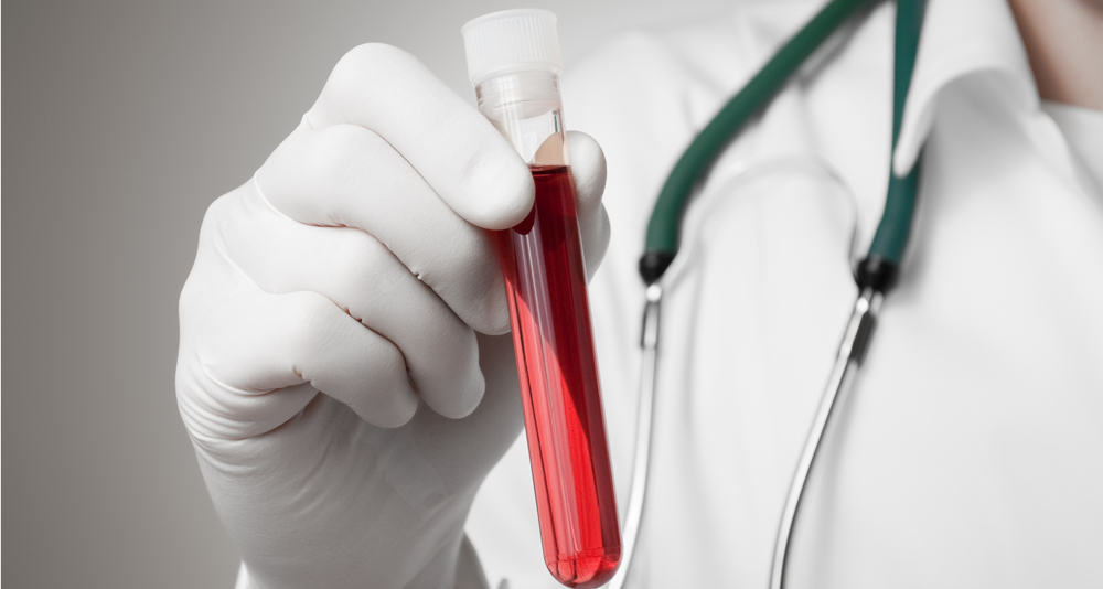 Biomarkers